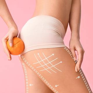 Pokožka s celulitidou