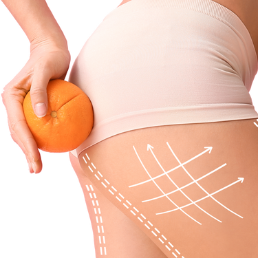 Neobotanics Anti-Cellulite Beauty Essence Nahrungsergänzungsmittel mit Grüntee-Extrakt, 60 Kapseln